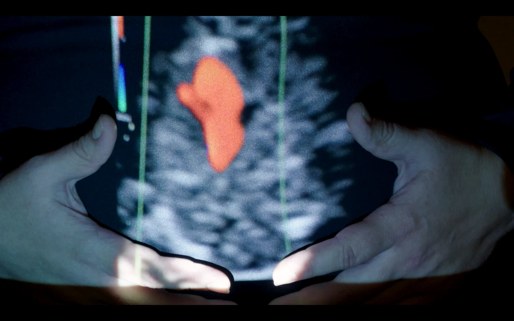Not This Baby in My Belly, projected ultrasound image across a body